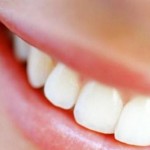 Denti più bianchi? Mangiando formaggio al mattino…